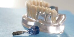 Eigentümer Bilder Fromme Hans-Werner Dr.med.dent. MSc Implantology Oralchirurg Arnsberg
