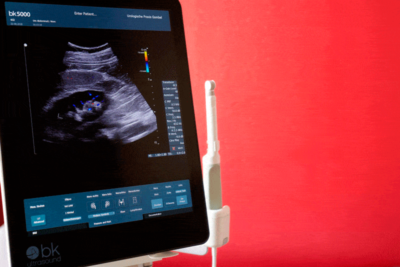 Kundenbild klein 6 Gombel Matthias Facharzt für Urologie u. Andrologie