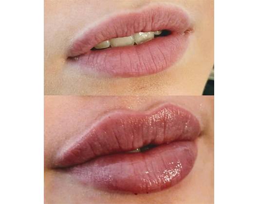 Kundenfoto 6 Xristina`s Nail & Beauty Lounge Kundenfoto 6 Xristina`s Nail & Beauty Lounge