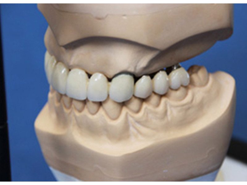 Jasper Dental-Labor GmbH aus Büdelsdorf