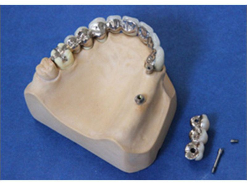 Jasper Dental-Labor GmbH aus Büdelsdorf