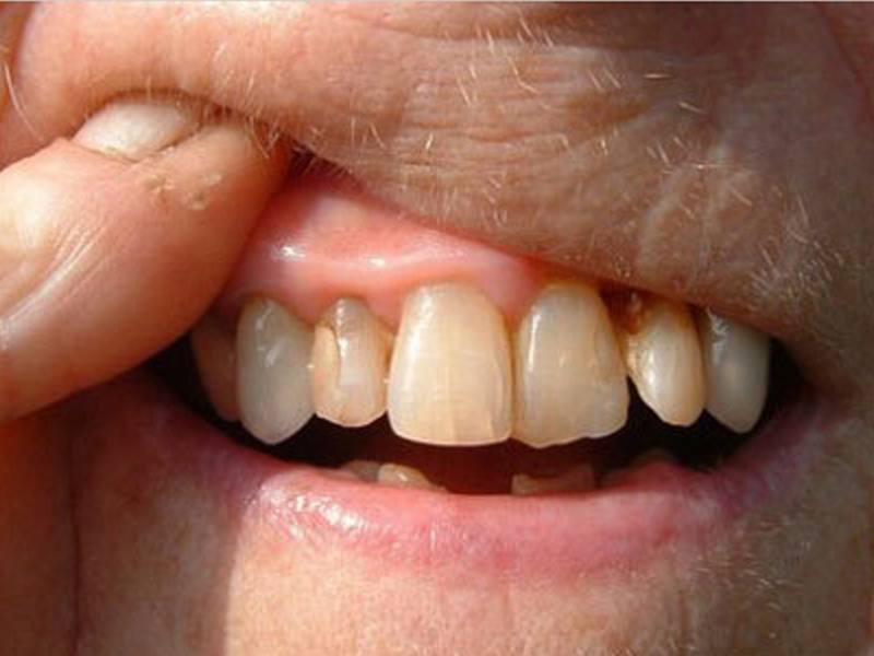 Dentallabor Segeberg GmbH aus Bad Segeberg