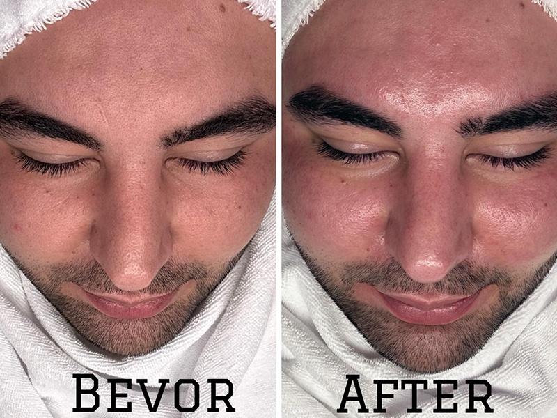 Gloria Glow Ästhetik & Skincare aus Hamburg