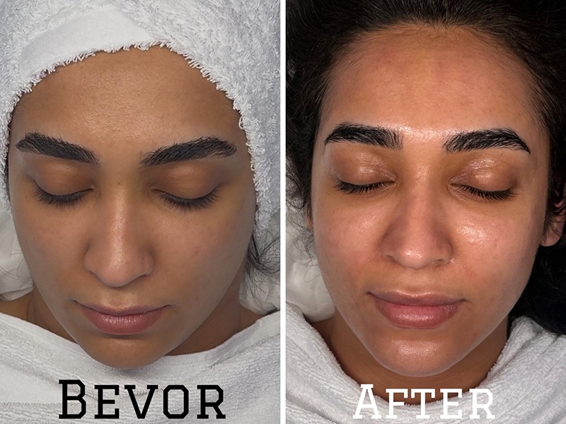 Gloria Glow Ästhetik & Skincare aus Hamburg