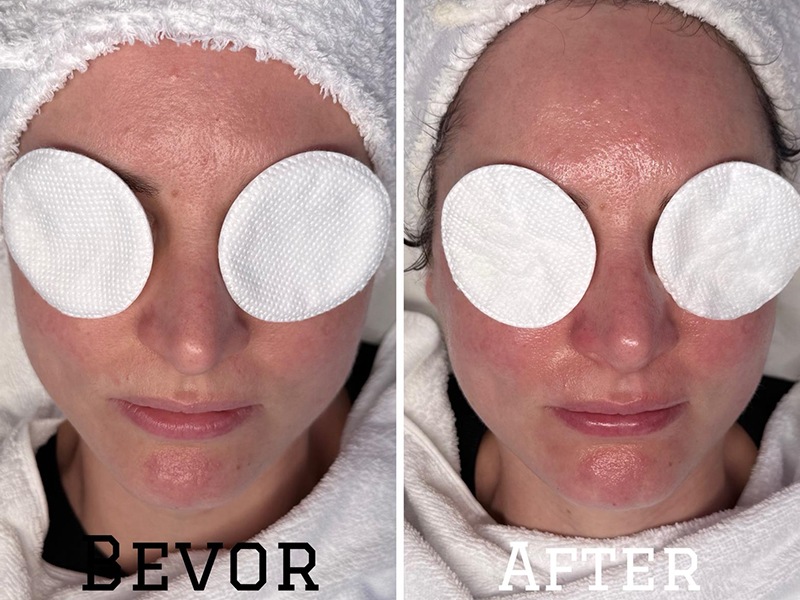 Gloria Glow Ästhetik & Skincare aus Hamburg