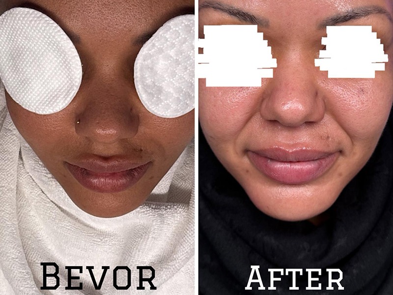 Gloria Glow Ästhetik & Skincare aus Hamburg