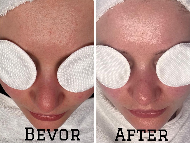 Gloria Glow Ästhetik & Skincare aus Hamburg